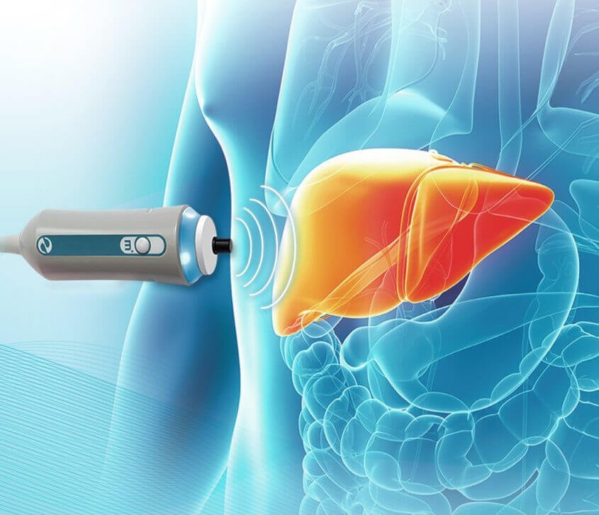 FibroScan in Dubai @almoosa (Liver Elastography)