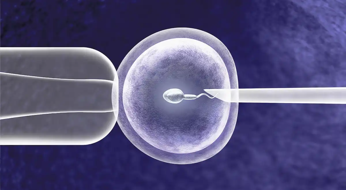 IVF - infertility and sub-fertility care at Almoosa clinics