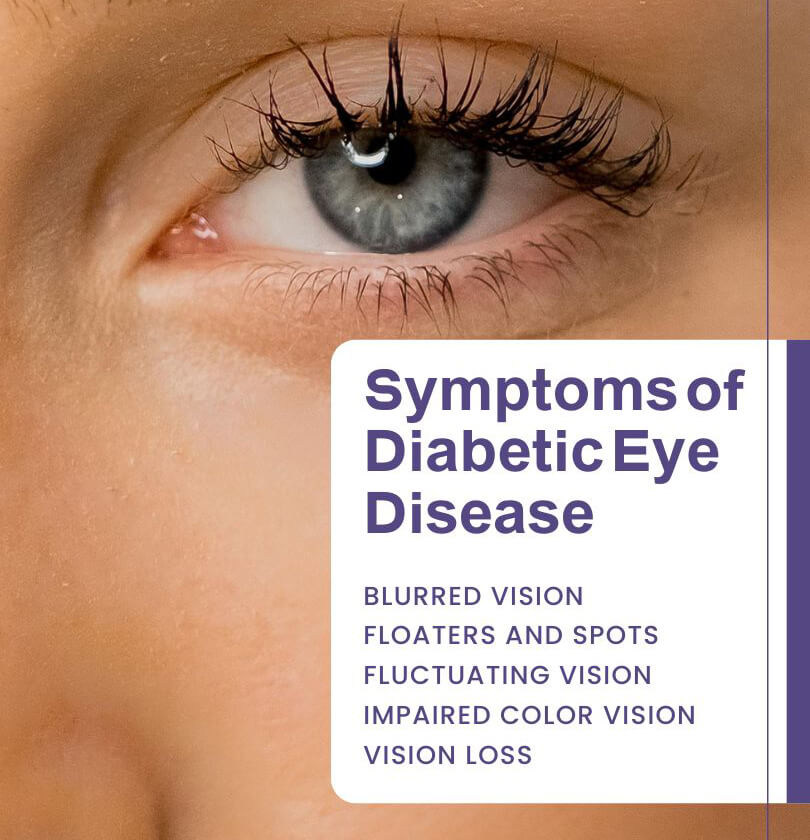 Diabetes Eye Care – Almoosa Clinics Dubai