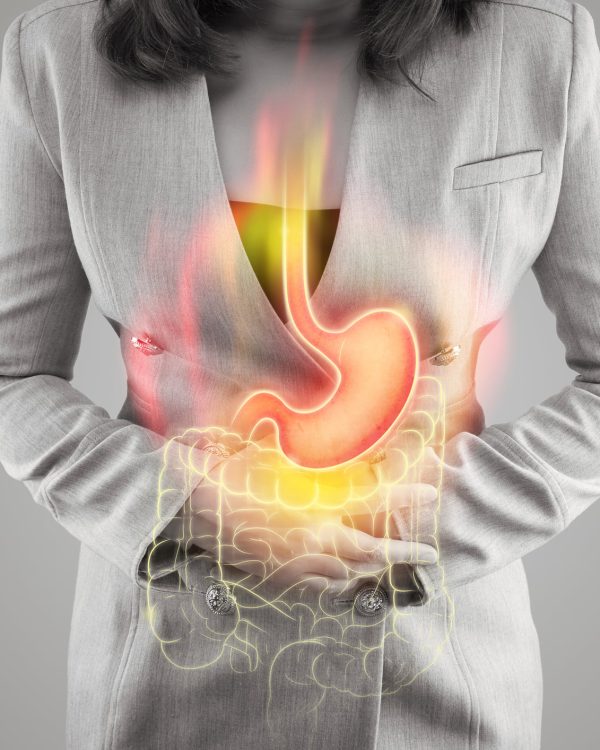 The illustration of stomach and large intestine is on the woman's body against gray background. Acid reflux. Female anatomy
